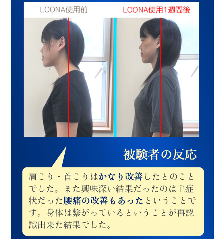 マルゲンライフ　LOONE