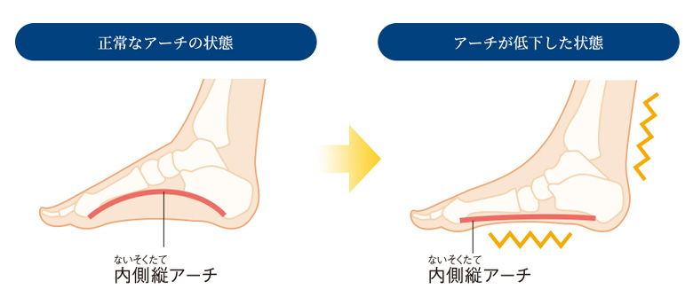 ソラーチ バーティカル